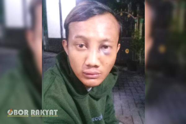 Sidoarjo, Obor Rakyat - Nasib apes menimpa penjaga warkop, pasalnya berniatan mengantar pesanan ke kamar penginapan ia malah menjadi dugaan penganiayaan. Ironisnya korban dihantam menggunakan paving.