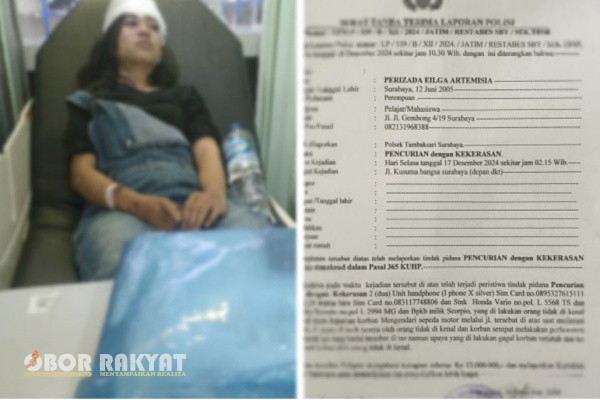 Surabaya, Obor Rakyat – Perizada Eilga Artemisia (19), warga Gembong Gang IV, Kota Surabaya, akhirnya menghembuskan nafas terakhir setelah sempat koma dan dirawat intensif di RSU Surabaya.
